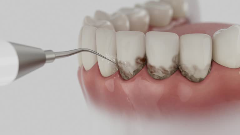 Reliable Dental Crowns And Bridges contractor in Baker County County, GA by Dentist Open Now